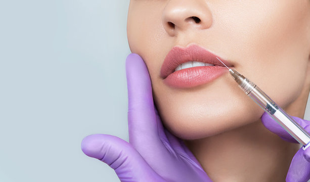 Lip filler image